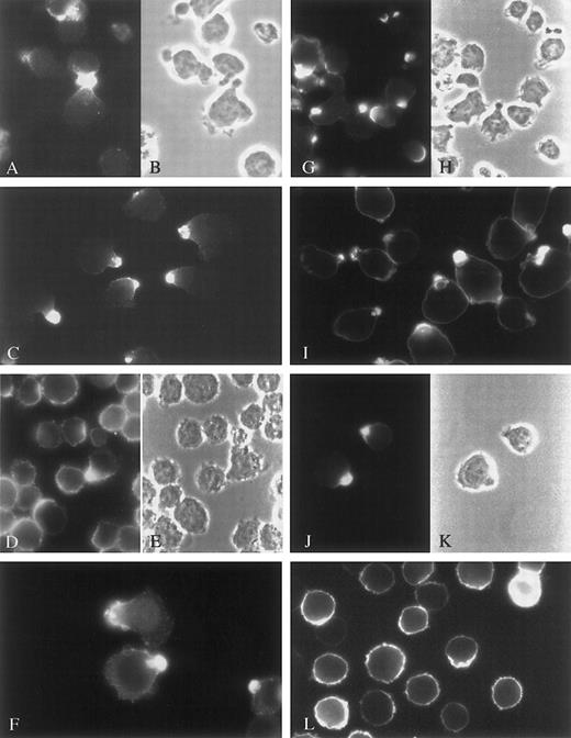 Fig. 1. Targeting of cell surface molecules to the uropods of myeloma cell lines. / CAG cells (A-C and G-H), ARP-1 cells (F and I), U-266 cells (D-E and J-K), and ARK cells (L) were stained against CD44 (A), ICAM-1 (C-F), or syndecan-1 (G-L). ICAM-1 and syndecan-1 staining was performed after fixation of the cells, whereas CD44 staining was performed on live cells at 37°C. A-B, D-E, G-H, and J-K are corresponding visual fields. The figure shows polarization of these molecules to uropods in cells expressing uropods. Nonpolarized cells have uniform expression of these molecules over the entire cell surface, as shown for syndecan-1 in ARK cells (L).