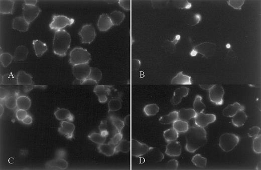 Fig. 2. Staining of CAG myeloma cells against CD43, CD38 and syndecan-1. / Evidence of uropod targeting as a dynamic process. CAG cells were stained against CD43 either at 20°C after fixation (A) or at 37° before fixation (B). Uropod restriction of CD43 was seen only when live cells were stained. (C) shows uniform expression of CD38 over the cell surface in cells stained live at 37°C. (D) shows lack of syndecan-1 polarization in cells stained live at 4°C.
