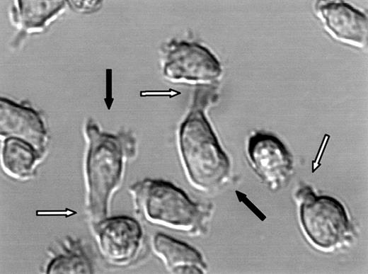 Fig. 4. Polarization of CAG myeloma cells. / DIC image of live CAG cells. White arrows point to uropods and black arrows point to lamellipodia.