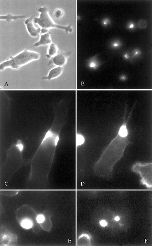 Fig. 5. Growth of cells on fibronectin alters polarization of cell surface molecules. / CAG cells were grown on fibronectin-coated chamber slides, stained against ICAM-1 or syndecan-1, fixed, and photographed through an inverted phase contrast or a fluorescence microscope. The phase contrast image (A) shows cell morphology with filopodia extending from the uropods. Cells in picture (B) (same field as A) are stained against ICAM-1 and cells in pictures (C-D) against syndecan-1. Both these molecules are polarized to an area located on the cell body at the neck of the uropod. (E-F) show syndecan-1 expression in uropods pointing toward the outer environment. In (E), the microscope is focused on the interface between the glass surface and the cells and the syndecan hotspots in the uropods appear blurred. (F) shows the same cells as in (E) with the focal plane elevated some 10 μm above the slide surface. Syndecan is now in focus, showing that the uropods are oriented upward.
