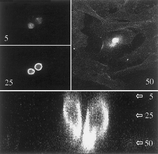 Fig. 8. Uropods act as attachment sites in contacts between myeloma cells and other cell types. / ARP-1 cells were seeded on a confluent layer of cells from the human osteosarcoma cell line HOS. After attachment of the myeloma cells, the coculture was stained with FITC–anti-syndecan-1 and studied with a confocal laser microscope. A stack of 60 pictures in the x-y plane was taken. The distance between adjacent pictures was 0.5 μm. Upper 3 pictures show 2 myeloma cells in the x-y plane with the picture number from the top of the stack indicated. The picture in level 50 also shows some staining of the adherently growing osteosarcoma cells. Lower panel is a z-section of the myeloma cells, showing uropods attaching to the osteoblast-like cells, which are faintly visible in the lower quarter of the picture.