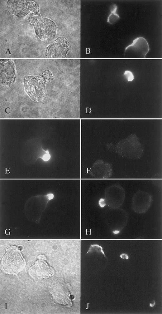 Fig. 9. The heparin-binding proteins HGF and OPG bind specifically to the uropod of polarized myeloma cells. / CAG (A-F and I-J) and ARP-1 cells (G-H) were incubated with 4 μg/mL of HGF alone (A-E and G-H), with HGF and 40 μg/mL heparin (F) or with 10 μg/mL OPG (I-J) at 37°C, fixed, and stained with a mab against HGF (A-H) or OPG (I-J) as described in “Patients, materials, and methods.” (A-B), (C-D), and (I-J) are corresponding visual fields. Strong uropod restriction of HGF and OPG binding is seen. Heparin prevented binding of HGF to the uropod (F).