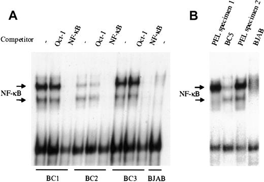 Fig. 1. NF-κB is constitutively activated in KSHV-infected PEL cell lines and patient specimens. / (A), Nuclear proteins extracted from latent cultures of BC1, BC2, and BC3 cells were examined by EMSA for DNA binding using a radiolabeled NF-κB–specific probe. All 3 PEL cell lines demonstrated protein/DNA binding with 2 distinct complex formations, compared with the uninfected negative control cell line BJAB. Cold competition using 50-fold molar excess of unlabeled NF-κB and Oct-1 oligonucleotides demonstrated the specificity of the protein/DNA binding complexes. (B), NF-κB activity in ex vivo KSHV-infected PEL cells was assessed by EMSA. Mononuclear cells were purified from 2 different patient effusions specimens, and the nuclear proteins were extracted and assessed for NF-κB/DNA binding. In one case, the amount of binding in the ex vivo specimen surpassed that of the BC5 cell line subsequently established from the same specimen. BJAB was used as the negative control for NF-κB activity.