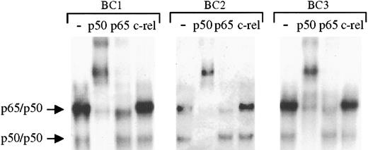 Fig. 2. The protein/DNA complexes in KSHV-positive PELs are primarily comprised of p65/p50 heterodimers and p50 homodimers. / To assess the components of the protein/DNA complexes, nuclear proteins extracted from latent cultures of BC1, BC2, and BC3 cells were incubated with antibodies to p50, p65, and c-rel before the addition of NF-κB–specific radiolabeled oligonucleotide. Compared with control samples in which no antibody was added (lanes 1, 5, and 9) addition of p50 antibody (lanes 2, 6, and 10) resulted in a complete shift of the lower complex and a large proportion of the upper complex in each cell line. Partial shifting of the upper complex was also seen on addition of p65 antibody, but no shifting of either complex was observed after addition of c-rel antibody.