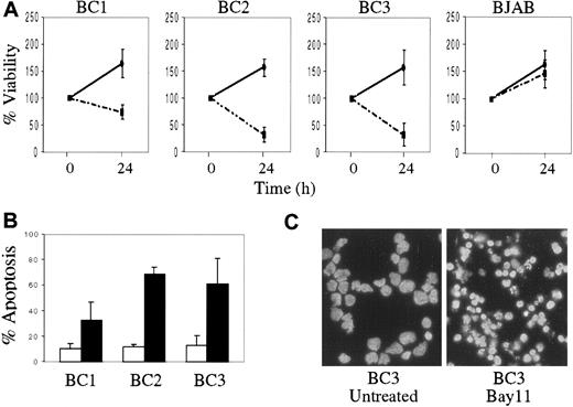 Fig. 5. Decreased cell viability and the induction of apoptosis in PEL cells treated with Bay 11. / BC1, BC2, BC3, and BJAB cells were placed in culture at 7.5 × 105 cells/mL without Bay 11 or with 5 μmol/L Bay 11 for 24 hours. (A), Cell viability was assessed by hemocytometry and trypan blue exclusion, and is reported as the percentage of viable cells remaining at 24 hours, relative to the initial viable cell number (100%). Data shown are compiled from 5 independent experiments, and are shown for both untreated (continuous line) and treated (dashed line) cells. (B), Induction of apoptosis in PEL cells on inhibition of NF-κB. 2 × 105 cells were labeled with FITC-conjugated annexin-V and analyzed by flow cytometry. The percentage of apoptotic cells from 4 independent experiments are reported for both untreated (white bar) and Bay 11 treated (black bar) cells. (C), DAPI staining of BC3 cells with or without treatment with 5 μmol/L Bay 11 for 24 hours shows significant nuclear condensation and fragmentation in the treated cells.