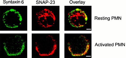 Fig. 5. Colocalization of SNAP-23 and syntaxin 6 in activated human neutrophils (PMNs) by confocal laser scanning microscopy. / Resting and PMA-activated human neutrophils were permeabilized and processed for double-labeled immunofluorescence with anti–SNAP-23 and anti–syntaxin 6 antibodies. The immuno-decorated areas were detected with the appropriate secondary antibodies coupled to phycoerythrin (red fluorescence for anti-SNAP-23) or FITC (green fluorescence for anti–syntaxin 6) by using confocal laser scanning microscopy, as described in “Materials and methods.” Overlay of the adjacent panels (right panels) shows colocalization of SNAP-23 and syntaxin 6 at the cell surface of activated human neutrophils. Areas of colocalization are yellow. Bar, 3 μm.