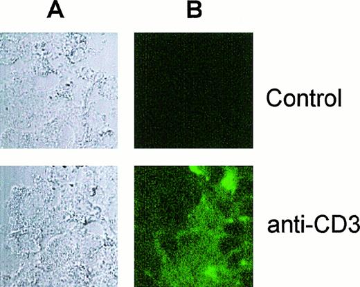 Fig. 8. Visualization of electropermeabilized neutrophils loaded with antibody by confocal laser scanning microscopy. / Electropermeabilized neutrophils were incubated in the absence (Control) or in the presence of FITC-conjugated anti-CD3 MoAb (anti-CD3) as described in Figure 7 and analyzed by confocal microscopy. The corresponding light transmission (A) and fluorescence (B) images are shown.