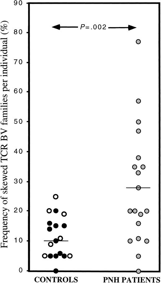 Fig. 2. Skewing in individual TCR BV families as determined by the 3-criteria analysis. / In this scattergram, the frequency of skewing in individual TCR BV family in the control group (black circles: healthy individuals, white circles: transfused, sickle cell disease or thalassemia patients) and the PNH patient group (gray circles) is shown. The mean frequency of skewing in the control and patient groups are 11.4% and 28%, respectively, P = .002.
