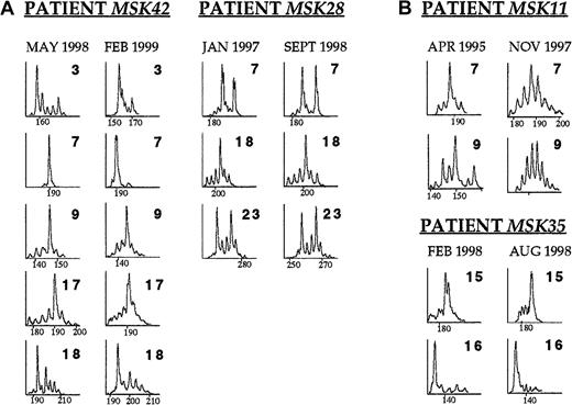Fig. 4. The time course of the TCR BV repertoire in selected patients with PNH. / (A) Patients MSK42 and MSK28 displayed skewing in several TCR BV families that remained unchanged over a period of 9 and 19 months, respectively. (B) Patient MSK11 received ATG in April 1995 because of worsening cytopenias. CDR3 profile analysis on blood sample taken just before the commencement of the treatment revealed skewing in families TCR BV7 and BV9. The patient responded to ATG with remarkable improvement of the hematologic parameters and CDR3 profile analysis on blood sample 2.5 years later showed diverse repertoire profiles in both families BV7 and BV9. Patient MSK35 received ALG in February 1998 because of severe hemolytic anemia. After a transient response, 6 months later the hematologic parameters were as before the commencement of the treatment. CDR3 size analysis performed on samples drawn before the initiation of treatment and 6 months later showed identical skewing patterns in TCR families BV15 and BV16.