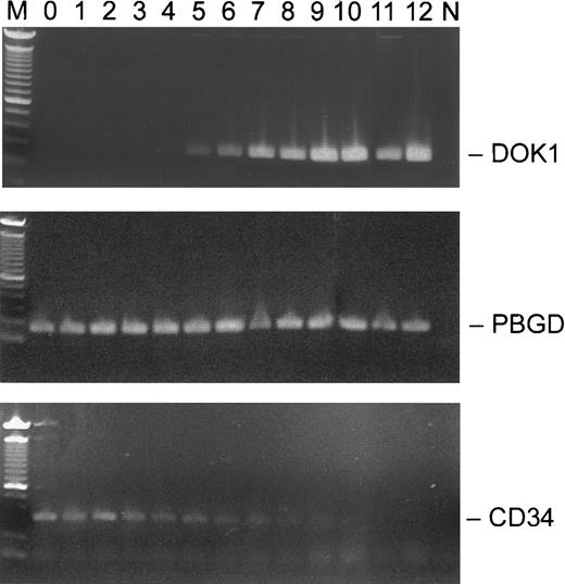 Fig. 3. Expression of. / DOK1 in CD34+ EPO-stimulated cells.CD34+ cells were grown in the presence of 1 U/mL EPO, and total RNA was purified from the cells collected on respective days 0-12. The RT-PCR products (top panel, DOK1; middle panel, PBGD; and lower panel, CD34) from each day were separated in 1.2% agarose gel. M indicates a 100-bp DNA ladder, and N indicates no DNA control.