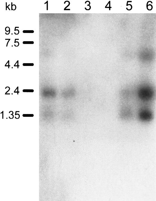 Fig. 4. Northern blot analysis of. / DOK1 expression in human hematologic tissues.Lanes 1 to 6 contain the following, respectively: 2 μg polyA+RNA from the human spleen, lymph node, thymus, peripheral blood leukocytes, bone marrow, and fetal liver. A32P-labeled DOK1 probe was used for hybridization. RNA size marker bands are indicated in the left margin of the blot.