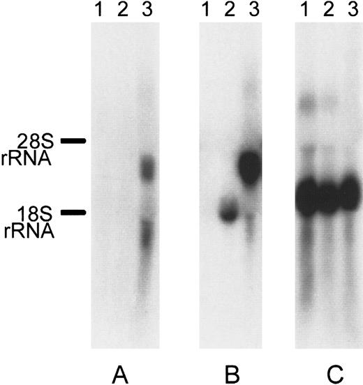 Fig. 5. Northern blot of pI2E- versus pDI2E-transfected K562. / Each lane contains 10 μg total RNA from untransfected K562 cells (lane 1), cells transfected with the pI2E vector (lane 2), and cells transfected with the pDI2E vector (lane 3). The 32P-labeled probes were used for hybridizations. (A) Membrane hybridized with a DOK1 probe. (B) Membrane hybridized with an EGFP probe. (C) Membrane hybridized with a β-actin probe.