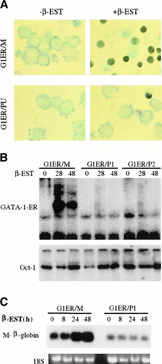 Fig. 5. Effect of overexpression of PU.1 on GATA-1 DNA binding and erythroid differentiation in an erythroid cell line dependent on GATA-1 for erythroid differentiation. / Overexpression of PU.1 blocks GATA-1 DNA binding and erythroid differentiation in an erythroid cell line dependent on GATA-1 for erythroid differentiation (A) G1ER cells were mock-infected (G1ER/M, top 2 pictures) or infected with a PU.1 retrovirus (G1ER/PU, bottom 2 pictures). Cells were stained with benzidine before (left side, EST) or after (right side, +β-EST) treatment with β-estradiol. (B) EMSA of GATA-1 DNA binding. Nuclear extracts were made from G1ER, G1ER/PU-1, and G1ER/PU-2 cells 0, 28, and 48 hours after β-estradiol induction as shown in the upper panel. The GATA-1 probe is the same as that used in Figure 3A. Oct-1 DNA binding was used as a control as shown on the lower panel. G1ER/PU-1, and G1ER/PU-2 are 2 individual clones of PU.1-virus–transduced G1ER cells. (C) Total RNA was prepared from G1ER/M and G1ER/PU cells at 0, 8, 24, and 48 hours after stimulation with β-estradiol. Then, 10 μg of each sample was loaded onto the gel and hybridized to a murine major-globin probe.31