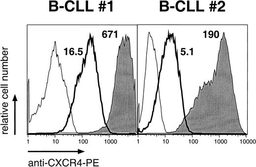 Fig. 5. Down-regulation of CXCR4 on CLL B cells cultured with NLC. / Histograms of leukemia B cells from 2 representative patients with CLL, indicating the relative red (anti-CXCR4) fluorescence intensity of CLL cells before (shaded) or after coculture with NLC (bold lines). Thin lines represent the isotype control staining. MFIR values are displayed next to each histogram.