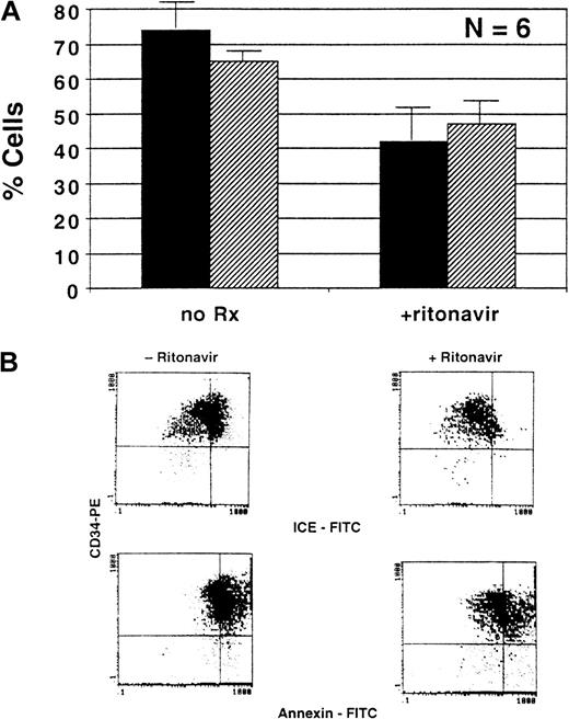 Fig. 3. Effect of ritonavir on apoptosis and cell death in normal BM. / Samples of purified CD34+ cells, obtained from normal uninfected controls, were cultured with and without ritonavir and stained with annexin V or ICE antibody after 72 hours. (A) Summary of results from 5 experiments performed to measure the number of apoptotic cells. ▪ Indicates annexin; ▨, ICE. (B) Examples of flow cytometry scattergrams showing annexin-stained cells cultured with and without ritonavir.