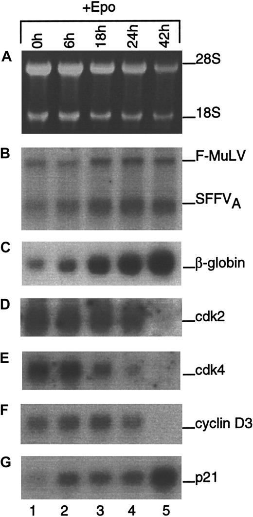 Fig. 2. Expression of cell cycle–associated mRNAs during terminal erythroid differentiation. / Total RNA was isolated from FVA erythroblasts at the indicated times during differentiation. Gel electrophoresis was performed, and ethidium bromide-stained rRNA was photographed as a control for loading (A). Northern blot analysis was performed using radiolabeled cDNA probes to Friend retroviral components (B), β-globin (C), cdk2 (D), cdk4 (E), cyclin D3 (F), and p21 (G).