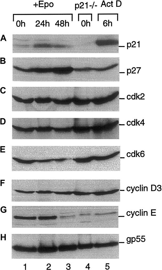 Fig. 3. Expression of cell cycle–associated proteins during terminal erythroid differentiation. / Total cellular protein was isolated from FVA erythroblasts cultured for 0, 24, or 48 hours with EPO (lanes 1-3), p21 null erythroblasts (lane 4), or p21+/+ erythroblasts exposed to the DNA-damaging agent ActD for 6 hours (lane 5). Proteins were electrophoretically separated in 12% polyacrylamide gels and probed with antibodies to p21, p27, cdk2, cdk4, cdk6, cyclin D3, or cyclin E. gp55 protein expression is shown as a control for protein loading.