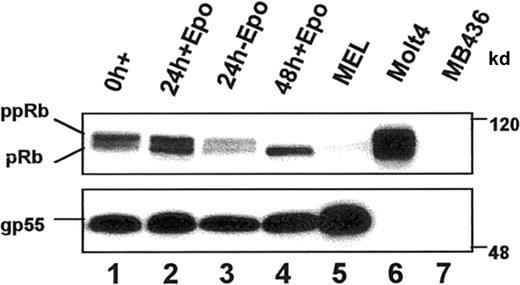 Fig. 4. Endogenous Rb protein expression during terminal erythroid differentiation. / Steady state levels and the phosphorylation status of Rb protein were determined by immunoblot analysis of whole cell lysates from FVA erythroblasts cultured with or without EPO for the indicated times. Known Rb− (MB436) and Rb+ (Molt 4) cell lines were included as controls. Equal amounts of protein were electrophoretically separated in a 7% polyacrylamide gel, transferred to nitrocellulose, and immunoblotted with anti-Rb. Positions of hyperphosphorylated (ppRb) and hypophosphorylated (pRb) Rb are indicated. gp55 protein expression is shown as a control for protein loading.