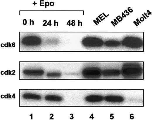 Fig. 5. Rb kinase activity of CDK immunoprecipitates during terminal erythroid differentiation. / Whole cell lysates from FVA erythroblasts (0, 24, 48 hours) (lanes 1-3), murine erythroleukemia (MEL) (lane 4), MB436 (lane 5), and Molt 4 (lane 6) cells were immunoprecipitated with antibodies to cdk6, cdk2, or cdk4. Immunoprecipitates were subjected to in vitro kinase assays using Rb as a substrate.