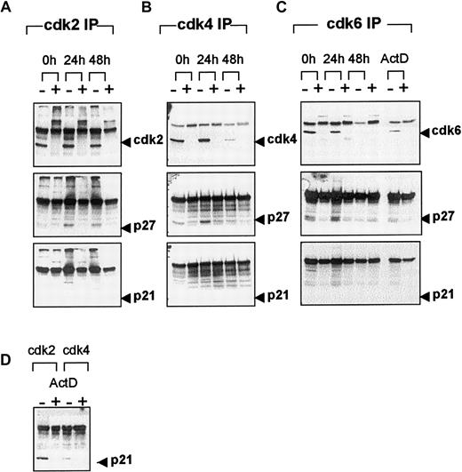 Fig. 6. CDK-immune complex formation during terminal erythroid differentiation. / Whole cell lysates from FVA erythroblasts cultured with EPO for 0, 24, or 48 hours were immunoprecipitated with anti-cdk2 (A), -cdk4 (B), or -cdk6 (C) in the absence (−) or presence (+) of relevant blocking peptide. FVA erythroblasts were cultured with EPO for 6 hours in the presence of ActD and immunoprecipitated with anti-cdk2 or -cdk4 (D) or -cdk6 (C) in the absence (−) or presence (+) of relevant blocking peptide. Immune complexes were electrophoretically separated in 12% polyacrylamide gels and transferred to PVDF membranes. Western blot analysis was performed with antibodies to cdk2, cdk4, cdk6, p27, or p21.