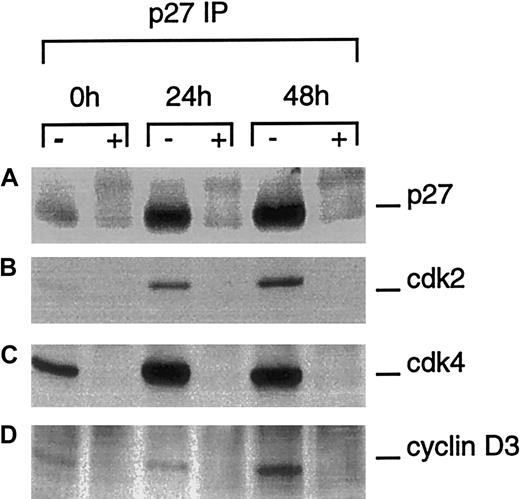 Fig. 7. p27 immune complex formation during terminal erythroid differentiation. / Whole cell lysates from FVA erythroblasts (0, 24, or 48 hours) were immunoprecipitated with anti-p27 in the absence (−) or presence (+) of blocking peptide. Immune complexes were electrophoretically separated in 12% polyacrylamide gels and transferred to PVDF membranes. Western blot analysis was performed with antibodies to p27, cdk2, cdk4, or cyclin D3.