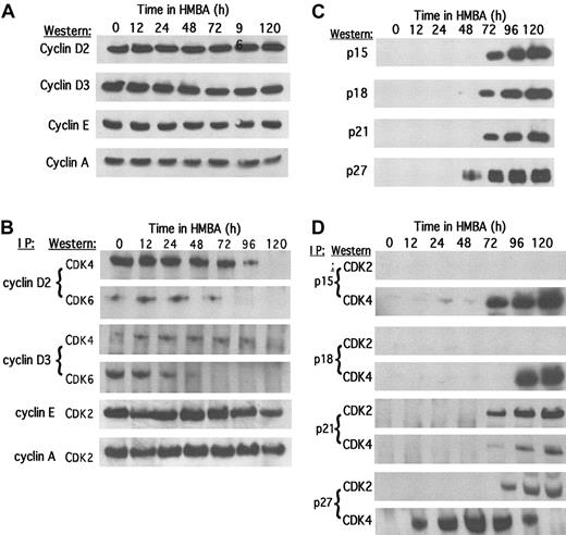 Fig. 2. Levels of cyclins and CDK inhibitors and their associations with CDKs during MEL cell differentiation. / Total cellular protein extracts were prepared at the indicated times of HMBA treatment, and the levels of (A) specific cyclins and (C) CDK inhibitors were determined by immunoblotting. Extracts were immunoprecipitated (IP) with antibodies specific for the indicated (B) cyclin or (D) CDK inhibitor as described in “Materials and methods.” The immunoprecipitates were subjected to sodium dodecyl sulfate–polyacrylamide gel electrophoresis (SDS-PAGE) and immunoblotted for the indicated CDK.