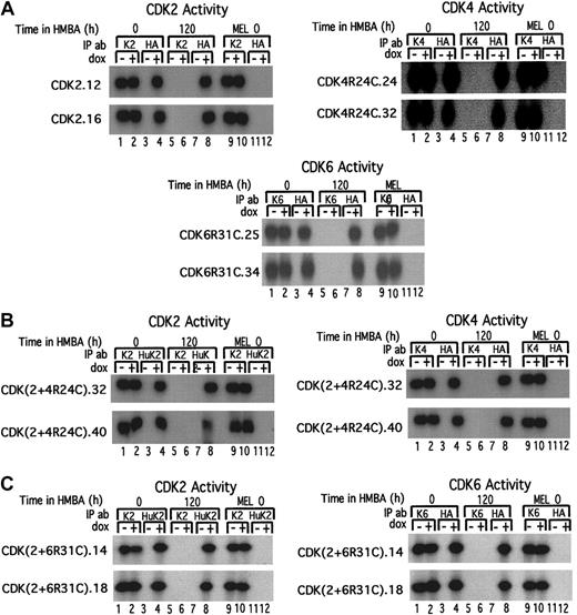 Fig. 6. Comparison of exogenous and endogenous kinase activities in undifferentiated and differentiated MEL cell CDK transfectants. / The indicated MEL cell transfectants were cultured in the absence (0) or presence (120) of HMBA for 120 hours and then further cultured in the absence (−) or presence (+) of Dox for 36 hours. Cell extracts were prepared and immunoprecipitated with antibodies specific for the endogenous murine CDKs (K2, K4, and K6) or the exogenous human HA-tagged CDKs (HA or HuK2). In doubly transfected cells (panels B and C) assays of exogenous kinase activities were performed by first immunoprecipitating with an antibody specific for the exogenous human CDK2 (HuK2), and after checking that the exogenous CDK2 was completely removed, the supernatant was immunoprecipitated with an anti-HA antibody specific for the exogenous HA-tagged (B) CDK4R24C or (C) CDK6R31C. The immunoprecipitates were incubated with γ-32P–ATP (γ-phosphorous 32–adenosine 5′-triphosphate) in the presence of either H1 or the GST-Rb C-terminal fragment, and the reactions were resolved by SDS-PAGE. For further details see “Materials and methods.”