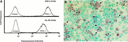 Fig. 2. HCLL activity is independent of PSGL-1. / (A) Flow cytometric analysis of PSGL-1 levels on KG1a cells and HL60 cells. Data shown are results obtained using P-selectin–Ig to stain cells, and therefore are reflective of PSGL-1 functional levels. Note that PSGL-1 expression is characteristic of both HL60 and KG1a cells. (B) L-selectin–mediated adherence of lymphocytes occurs on KG1a cells but not HL60 cells. Representative result of lymphocyte adherence assay performed on cytospin mixture of KG1a cells and HL60 cells. Immunohistochemical staining for CD34 antigen (pink stain) identifies KG1a cells. As demonstrated by arrows, note that lymphocytes (solid blue dots) adhere only to pink (KG1a) cells (background stain is methyl green-thionin, 250 × magnification).