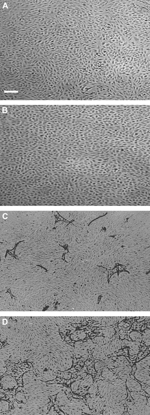 Fig. 1. Capillary-like tube formation is increased under hypoxic conditions. / hMVECs were cultured on top of a 3-dimensional fibrin matrix in M199 supplemented with 10% HS and 10% NBCS under (A,C) normoxic or (B,D) hypoxic culture conditions and were not stimulated (panels A,B) or stimulated (panels C,D) with 10 ng/mL each FGF-2+TNF-α. After 3 days of culturing, nonphase photomicrographs were taken.The bar indicates 300 μm.