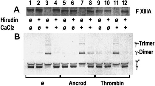 Fig. 3. Gel-filtered pooled plasma from healthy blood donors. / Immunoblots are shown from an in vitro experiment on the effect of ancrod and thrombin on proteolytic release of the factor XIII activation peptide and the catalytic activity of factor XIII leading to the formation of fibrin γ-chain dimers and trimers. Pooled plasma from healthy blood donors was incubated without enzyme, with ancrod, or with thrombin in absence or presence of recombinant hirudin and calcium chloride, as specified in the graph. Panel A shows an immunoblot using a polyclonal antiserum against the activation peptide of factor XIII. A polyclonal antiserum against the γ-chain of fibrinogen was used for the immunoblot in panel B. Addition of thrombin (lane 11) or intrinsic formation of thrombin after addition of calcium in the absence of hirudin (lane 3) led to disappearance of the factor XIII band and appearance of cross-linked γ-chains. Parallel addition of ancrod and calcium chloride led to the formation of γ-chain cross-links, also in presence of hirudin, even though there is no decrease in the factor XIII band. This indicates that the factor XIII zymogen is able to cross-link desAA-fibrin γ-chains formed by the action of ancrod in the presence of calcium.