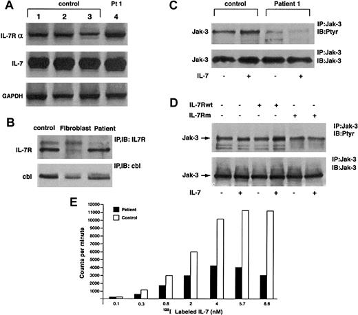 Fig. 2. IL-7 and IL-7Rα. / (A) IL-7 and IL-7Rα RNA expression is normal in patient cells. PCR was performed with IL-7 and IL-7Rα specific primers on cDNA from patient 1 and 3 control EBV cell lines. Control GAPDH products are also shown. (B) IL-7R expression is not altered. Il-7Rα was immunoprecipitated from lysates of control and patient EBV cell lines and human fibroblasts (negative control) and Western blotted with anti–IL-7R antibody. Anti-Cbl immunoprecipitation and Western blot were performed as a positive control. (C) Absence of Jak-3 tyrosine phosphorylation after IL-7 stimulation in patient cells. Patient and control cells were incubated for 10 minutes ± 30 ng/mL rIL-7. Lysates were precipitated with anti–Jak-3 antibody and blotted with antiphosphotyrosine (top panel) and anti–Jak-3 after stripping (bottom panel). (D) COS-7 cells were transfected with expression vectors encoding γc, Jak-3, and either wild-type or mutant IL-7Rα as indicated (top). Cells were incubated ± IL-7 for 10 minutes, lysed, and immunoprecipitated with anti–Jak-3 antibody and subsequently blotted with either antiphosphotyrosine (top) or anti–Jak-3 (bottom) antibodies. (E) Specific binding of125I-labeled IL-7 to EBV-transformed B cells derived form patient or healthy donor. IL-7 binding is presented as counts after subtraction of the background binding measured in the presence of a 100-fold excess of unlabeled IL-7.