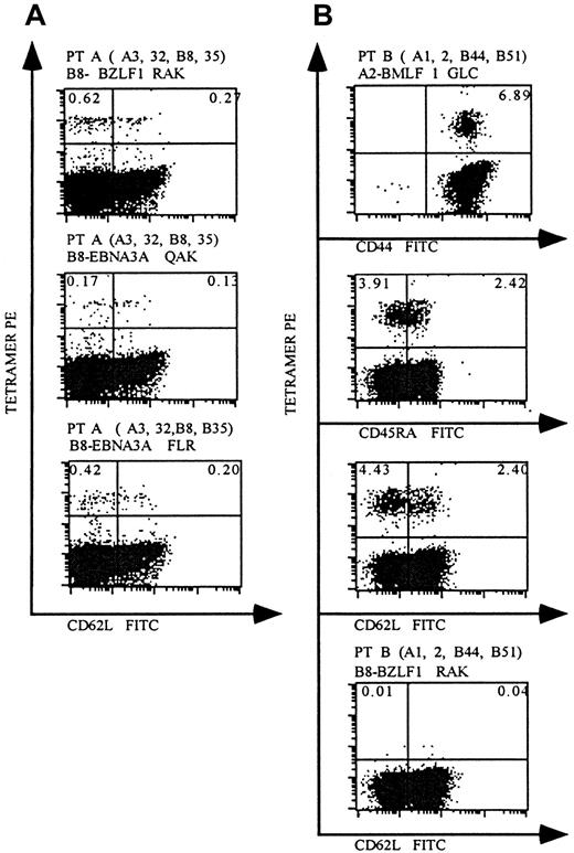 Fig. 3. EBV-specific CD8 T cells are present in the peripheral blood of allo-PBSCT recipients. / PBMCs were obtained from 2 allo-PBSCT recipients at 155 days (patient A) and 212 days (patient B) following transplantation. (A) Patient A was triple-stained with anti-CD8+, CD62L, and HLA tetramers. (B) Patient B was stained with tetramer and anti-CD8 with either anti-CD44, CD45RA, or CD62L. Finally, patient B was stained with an unrelated tetramer/peptide complex as a negative control. The HLA haplotype and the HLA tetramer/peptide complex used for staining are indicated above each plot. Each dot-plot is gated on live CD8+ T cells, and the percentage of CD8 T cells that stain with the respective tetramer is indicated in the upper quadrants of each plot.