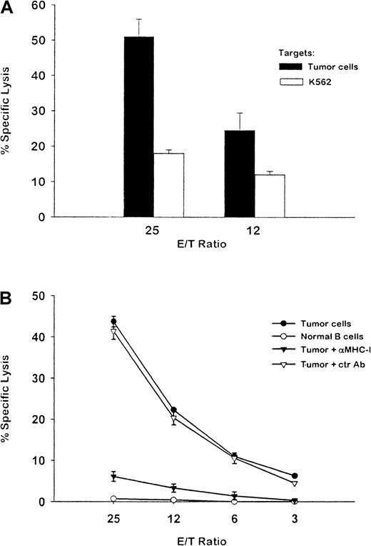 Fig. 3. Cytotoxic T-cell activity against fresh autologous myeloma cells. / A T-cell line was established by coculturing PBMC from patient HR with autologous dendritic cells (DCs) pulsed with myeloma Id. (A) The T-cell line was assayed at the indicated ratios of effector to target for lysis of chromium 51–labeled autologous plasmacytoma cells (solid bars) or natural killer–sensitive K562 cells (open bars) after repeated stimulation. (B) The T cells were assayed for lysis of indium 111–labeled autologous tumor cells. Tumor-specific cytotoxicity was blocked by pretreatment of tumor targets with an anti-MHC class I MoAb but not with a control antibody. Autologous normal B cells were used as a control target for specificity. The results shown are representative of 2 experiments.