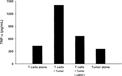 Fig. 4. Tumor-specific, MHC class I–restricted release of cytokines by the T-cell line. / T cells derived from patient HR were assayed for release of TNF-α in response to stimulation by autologous plasmacytoma cells. The T cells (2.5 × 106) were cultured for 5 days with fresh autologous plasmacytoma cells (5 × 104) in either the absence or presence of an anti-MHC class I MoAb. T cells alone or tumor cells alone were used as controls. Supernatants from the cultures were harvested and assessed for TNF-α production by ELISA.