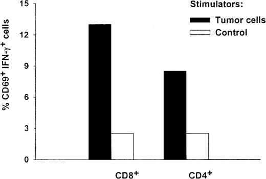 Fig. 5. Intracellular cytokine and phenotype analysis of T cells from patient HR. / After 2 in vitro stimulations by DCs pulsed with Id protein, the antigen specificity and T-cell phenotype of HR's T cells were analyzed simultaneously by FastImmune assay. Effector cells were coincubated with stimulators at a ratio of 5 to 1 at 37°C. Autologous tumor cells (solid bars) or autologous PBMC (open bars) were used as stimulators. After a 2-hour coincubation, Brefeldin A was added to block secretion of cytokines. Three hours later, cells were washed and fixed with 1% paraformaldehyde. Fixed cells were permeabilized and triple stained with direct conjugated antibodies of CD69-phosphatidylethanolamine, CD4– or CD8–peridinin chlorophyll protein, and IFN-γ–fluorescein isothiocyanate, conjugated. Cell samples were then acquired by a fluorescence-activated cell sorter (FACScalibur) cytometer. Either CD4+ (right panel) or CD8+ (left panel) T cells were gated on, and their expression of CD69 and intracellular cytokine was examined. Percentages of activated double-positive cells are shown.