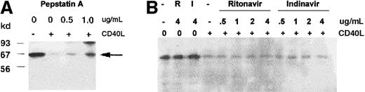 Fig. 2. Pepstatin A blocks CD40-mediated TRAF3 depletion and NF-κB activation. / Western blot analysis of cytosolic TRAF3. KMH2 cells were stimulated with CD40L for 45 minutes in the presence of the indicated concentrations of pepstatin A (A), or ritonavir or indinavir (B). The cytoplasmic fractions were analyzed by Western blotting with anti-TRAF3 antibody. The arrow indicates the position of TRAF3. Pep indicates pepstatin A; R, ritonavir; I, indinavir.