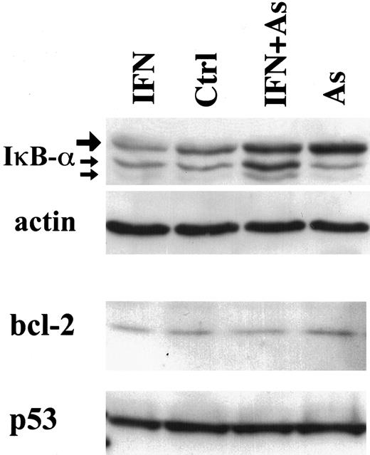 Fig. 3. Effects of IFN, As, and their combination on the expression of IκB-α, bcl-2, and p53 in HuT-102 cells treated for 48 hours with IFN and/or As. / For IκB-α expression, the upper band (large arrow) represents the 36-kd major IκB-α protein, also observed in CEM cells (not shown). The lower bands of 34 and 32 kd (small arrows) presumably represent N-terminal proteolytic forms of IκB-α 48 up-regulated by As-IFN treatment.