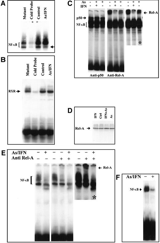 Fig. 4. Effects in an HuT-102 cell line. / Effects of a 48-hour treatment of IFN and As in an HuT-102 cell line on the activation of the transcription factors NF-κB (A) and RXR (B) assessed by electrophoretic mobility shift assay using consensus oligonucleotide probes for NF-κB and RXR, respectively. Note that As-IFN significantly diminishes 1 of the 2 NF-κB complexes (arrow in A). (C) NF-κB subunit specificity was determined by using antibodies to the NF-κB components p50 and p65/RelA, resulting in “supershift” (arrow). A longer exposure (*) of the RelA supershift is shown. (D) Effects of IFN, As, and their combination on the expression of p65/RelA protein. Combined As-IFN treatment dramatically decrease Rel-A–containing complexes without inducing Rel-A degradation. Effects of a 48-hour As-IFN treatment on NF-κB binding in C91-PL cell line (E) and fresh ATL leukemic cells (F). As above, subunit specificity was determined by “supershift” (arrow) and * indicates longer exposure.