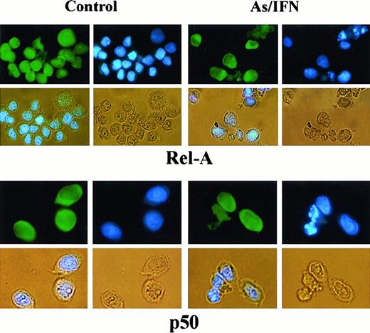 Fig. 5. Effects of 48-hour As-IFN treatment on the subcellular distribution of the NF-κB subunits RelA or p50. / Effects were determined by immunofluorescence (green). Nuclear staining was performed by Hoechst (blue). Phase-contrast images are also shown (yellow). Treatment with As-IFN induces the cytoplasmic transfer of Rel-A but not p50.