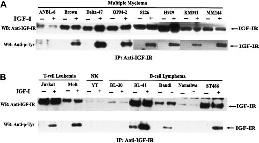 Fig. 1. Expression and autophosphorylation of IGF-IR. / Cells were serum-starved for 18 hours and were untreated (−) or treated (+) with IGF-I. Lysates from 1 × 107 cells were incubated with anti–IGF-IR antibody, and immunoprecipitates were prepared and analyzed as described in “Materials and methods.” Blots were probed with antibody to the IGF-IR (A) or phosphotyrosine (B).