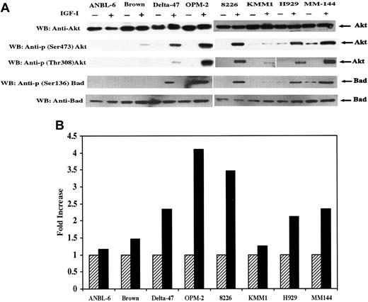 Fig. 3. IGF-I–induced phosphorylation and kinase activity of Akt. / (A) Serum starved cells were untreated (−) or treated (+) with IGF-I. Total protein extracts (25 μg) from each cell line indicated were subjected to SDS-PAGE and blotted with anti-Akt, anti-p (Ser473) Akt, anti-p (Thr308) Akt, Anti-Bad, or anti-p (Ser136) Bad. (B) Cells were serum-starved for 18 hours and untreated (hatched bar) or treated (solid bar) with IGF-I. Lysates from 1 × 107 cells were immunoprecipitated with anti-Akt antibody and subjected to an in vitro kinase assay as described in “Materials and methods.” IGF-I–stimulated Akt activity is presented as fold increase, calculated by dividing the cpm of nonstimulated cells by the cpm of IGF-I–stimulated counterparts. Data represent average values of 2 independent assays.