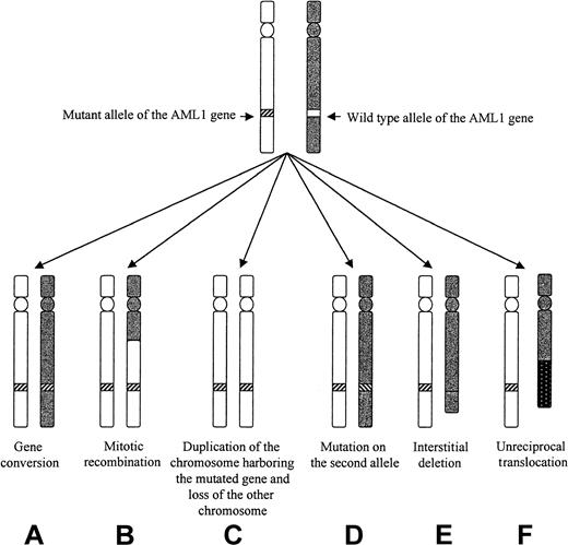 Fig. 5. Different mechanisms that could lead to LOH of the AML1 gene in patients 3 to 5. / Mechanism C, D, E, and F could be ruled out in the 3 patients. Mechanism A seemed to apply to patient 3, and mechanism B applied to patients 3 and 5.