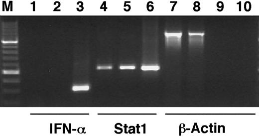 Fig. 3. IFN-α1 mRNA cannot be detected after ATRA stimulation of U-937 cells. / U-937 cells were stimulated by ATRA for 48 hours, total RNA was prepared, and cDNA was synthesized by RT-PCR. PCR was run with cDNA preparations from untreated (lanes 1, 4, 7) or ATRA-stimulated cells (lanes 2, 5, 8) with primers specific for IFN-α1 (lanes 1-3), Stat1 (lanes 4-6), or β-actin (lanes 7, 8). To test for genomic contamination, PCR was also run with preparations of mRNA without reverse transcriptase, from untreated (lane 9) or ATRA-stimulated (lane 10) U-937 cells, using β-actin primers. Positive controls were lanes 3 and 6.