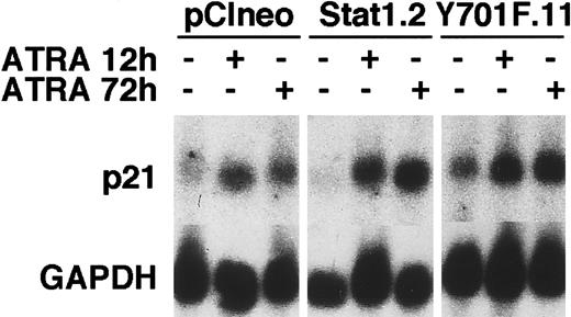 Fig. 9. ATRA-induced p21 mRNA expression is not repressed by the expression of Stat1HAY701F. / pCIneo, Stat1.2, and Y701F.11 cells were treated with ATRA for 12 and 72 hours or left unstimulated. Total RNA was prepared and Northern blot analysis was done with p21 and GAPDH probes.