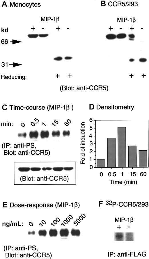 Fig. 1. Phosphorylation of CCR5 induced by chemokine MIP-1β. / (A) Human monocytes were incubated in the presence or absence of MIP-1β (1 μg/mL) for 1 minute at 37°C. Cell lysates (20 μg) were electrophoresed in the presence (reducing +) or absence of 2-mercaptoethanol, transferred to IP membranes, and then immunoblotted with a polyclonal anti-CCR5 antibody. (B) CCR5-transfected human kidney embryonic 293 cells (CCR5/293) received the same treatment described in panel A. (C) Human monocytes incubated at designated times with MIP-1β (1 μg/mL) were lysed, and 200 μg cell lysates were immunoprecipitated with an antiphosphoserine antibody. The immunocomplexes were electrophoresed followed by immunoblotting with anti-CCR5 antibody. The inset shows the detection by immunoblot of CCR5 in 20 μg cell lysates prior to immunoprecipitation. (D) Densitometric measurement of the levels of phosphorylated CCR5 shown in panel C normalized to the receptor contents (inset in panel C). (E) Induction of CCR5 phosphorylation by different concentrations of MIP-1β. (F) An increased phosphorylation of CCR5 was detected by an anti-FLAG antibody in32phosphorus-labeled 293 cells transfected with FLAG-tagged CCR5 cDNA.