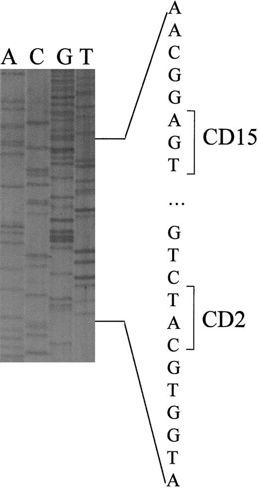 Fig. 2. Sequence analysis of a cloned β-globin gene in the region of exon 1 from a carrier of the nonsense mutation (TGG→TGA) at codon 15 in cis to the absence of a ApaLI site at codon 2. / The DNA sequence around codons 2 and 15 is indicated on the right.