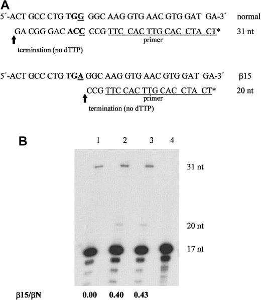 Fig. 4. Differential termination of primer extension analysis of peripheral blood reticulocyte RNA from a normal subject or from 2 β15 carriers. / (A) Illustration of the principle underlying the experiment. The end-labeled (represented by *) 17-mer oligonucleotide (underlined sequence), described in “Materials and methods,” was hybridized to the mRNA, and reverse transcription was performed in the absence of dTTP. Products of 31 and 20 nucleotides resulted from the extension of normal and mutant (β15) alleles, respectively. Arrows represent the site of differential termination of primer extension. (B) Representative autoradiograph of PAGE separation of normal cDNA (lane 1), and cDNA from 2 β15 carriers (lanes 2 and 3, respectively). Lane 4 contains an end-labeled 17-nucleotide primer as a size marker. The position of the full-length primer extension product is on the right. The average ratio of mutated versus normal allele expression, using results from 2 independent experiments, is indicated at the bottom.