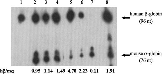 Fig. 5. Representative autoradiograph of the primer extension analysis of MEL cells RNA. / Cells underwent erythroid differentiation induction, and were transfected with β5 (lane 2), β15 (TGG→TAG) (lane 3), β15 (TGG→TAA) (lane 4), β15 (TGG→TGA) ApaLI-positive at codon 2 (lane 5), β17 (lane 6), β26 (lane 7), or normal (lane 8) β-globin genes. Lane 1 contains 250 ng human reticulocyte RNA. Experiment was carried out as described in “Materials and methods” and Figure 1. The position and length of human β- and mouse α-globin cDNA are indicated on the right. Levels of human β-globin mRNA (hβ) relative to endogenous mouse α-globin mRNA (mα) are indicated at the bottom.