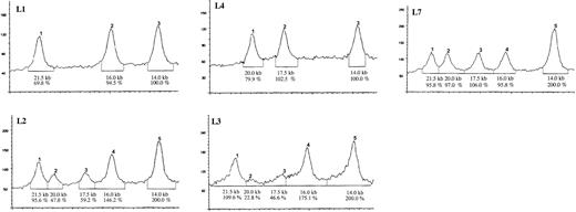 Fig. 2. Densitometric analysis of the Southern blot analysis shown in Figure 1. / Below each curve the size of the corresponding Southern blot band is given in kb. The signal density is given in percent of area under the curve where the 14-kb signal, which is not involved in the distal intron 22 inversion, was set to 100% (corresponding to one X chromosome in L1 and L2) and 200% (representing the 2 X chromosomes in L2, L3, and L7). L1: Normal pattern with bands at 21.5 kb, 16 kb, and 14 kb. L4: Distal intron 22 inversion in the index patient with bands at 20 kb, 17.5 kb, and 14 kb. L7: Heterozygous female carrier with equal 50% densities of the bands at 21.5 kb, 20 kb, 17.5 kb, and 16 kb. The band at 14 kb shows double density because it represents the proximal telomeric copy of the F8A gene that is not involved in the inversion process. L2 and L3: Somatic mosaicism in lymphocytes (L2) and fibroblasts (L3) of the patient's mother, with reduced density of the signals showing the inversion at 20 kb and 17.5 kb and corresponding increase in density of the bands at 21.5 kb and 16 kb, respectively.