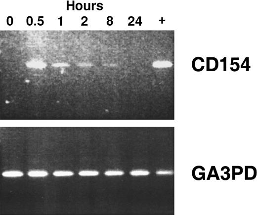 Fig. 2. CD154 transgene expression in blood mononuclear cells isolated after infusion of autologous Ad-CD154–transduced CLL cells. / To demonstrate CD154 transgene and the housekeeping gene glyceraldehyde-3-phosphate dehydrogenase (GA3PD) expression, RT-PCR was performed on messenger RNA (mRNA) isolated from blood mononuclear cells isolated from patient 003 prior to cell infusion and 0.5, 1, 2, 8, and 24 hours thereafter. The far right lane (+) represents RT-PCR performed with mRNA prepared from an aliquot of Ad-CD154–transduced cells used for infusion.